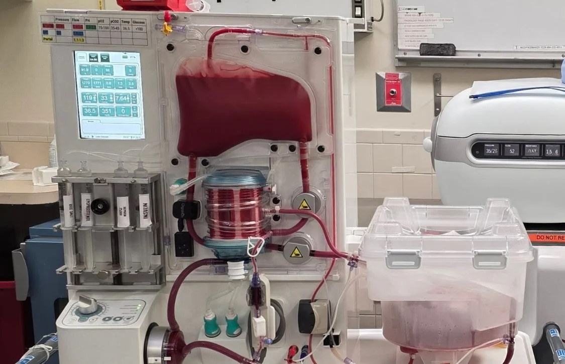 Kidney Normothermic Machine Perfusion and the Push to Reduce Organ Discard