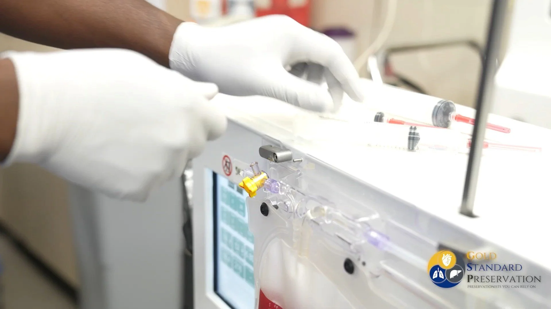Scalable Strategies for Ambitious Transplant Program Expansion