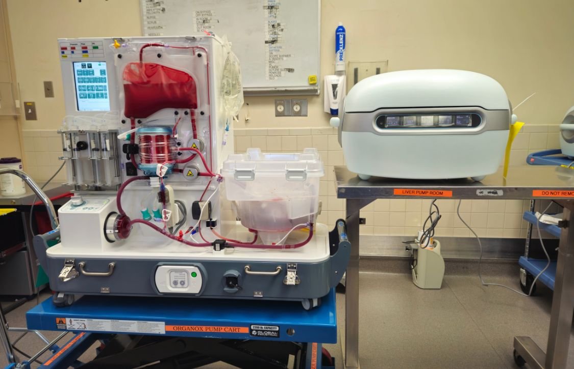 Machine Perfusion