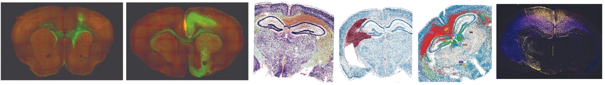 Collection of scientific microscopy images showing cross-sections of brain tissue with various staining and highlighting techniques in different colors including orange, green, purple, red, blue, and yellow.