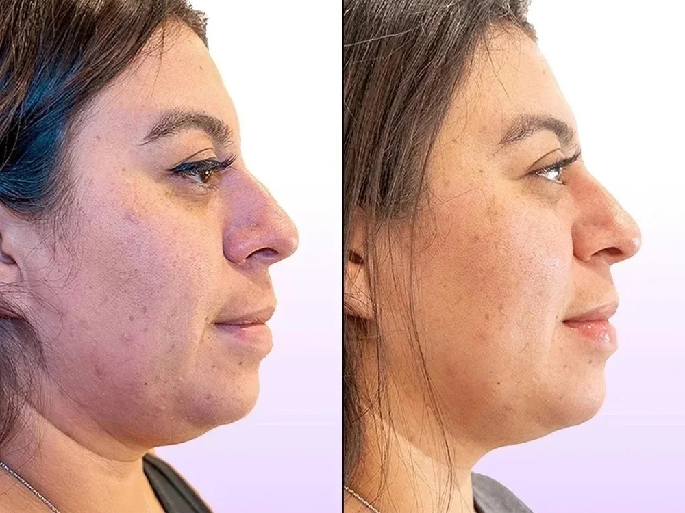 Facial skin appearance result