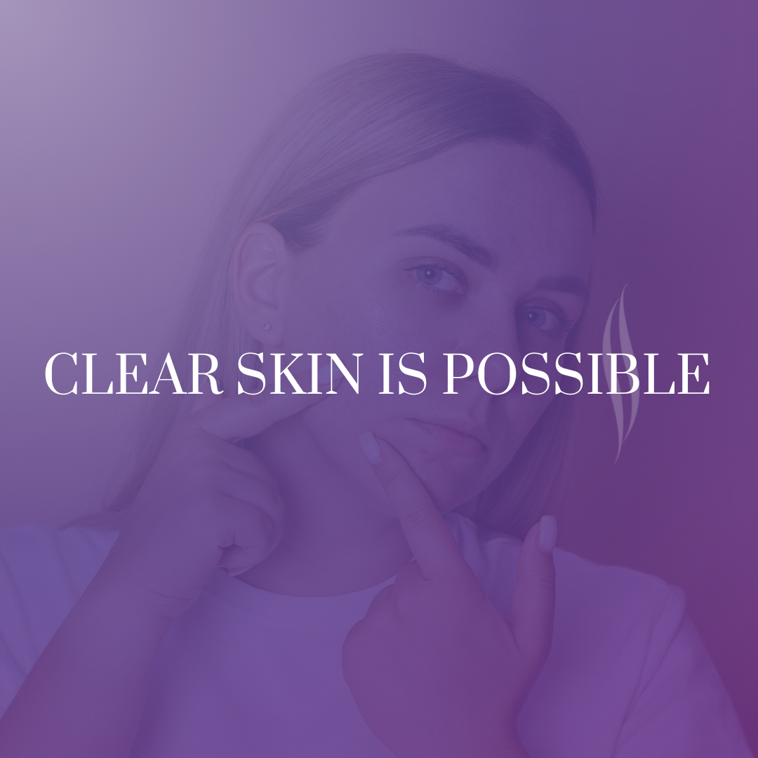 Teenage Acne Holding You Back?