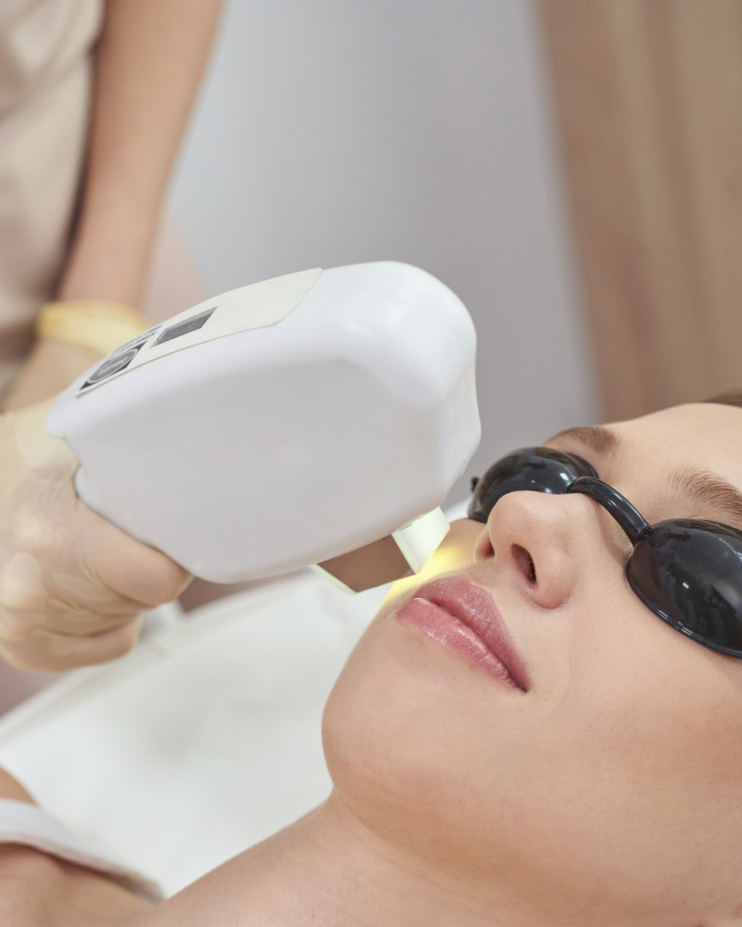 A woman receiving a laser skin treatment while wearing protective sunglasses.