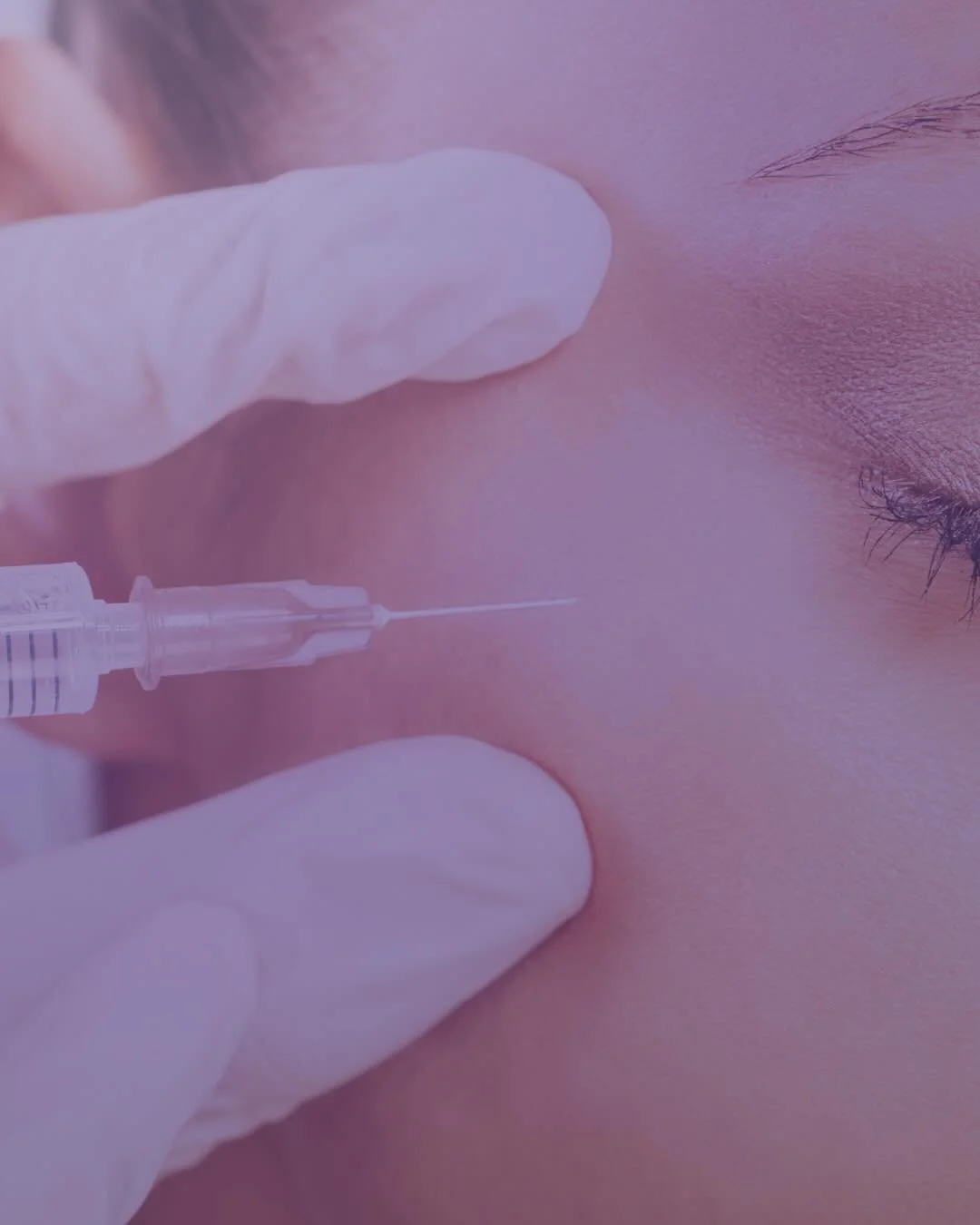 Close-up of a person receiving a cosmetic injection like Botox near the eye with medical gloves holding the syringe.