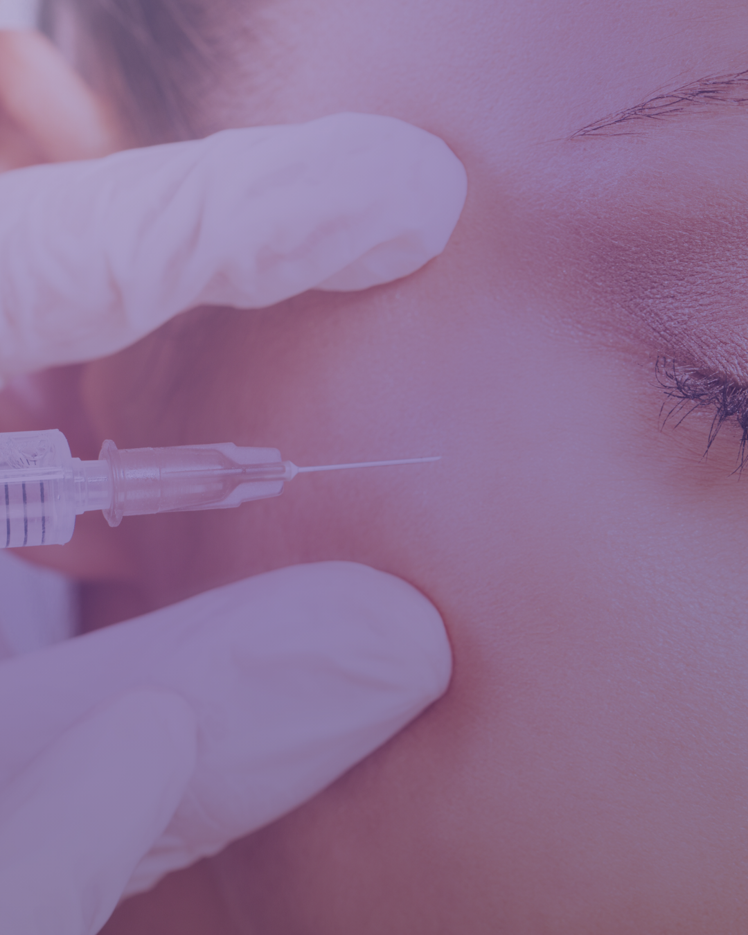 Close-up of a person receiving a cosmetic injection near the nose, with medical gloves holding the syringe.