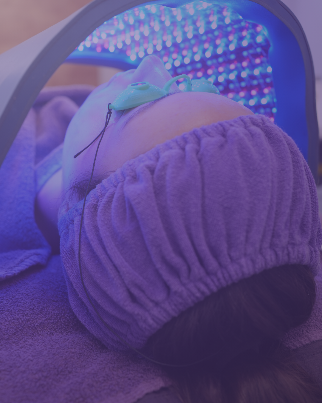 Acne Before and After Photo Skin Studio