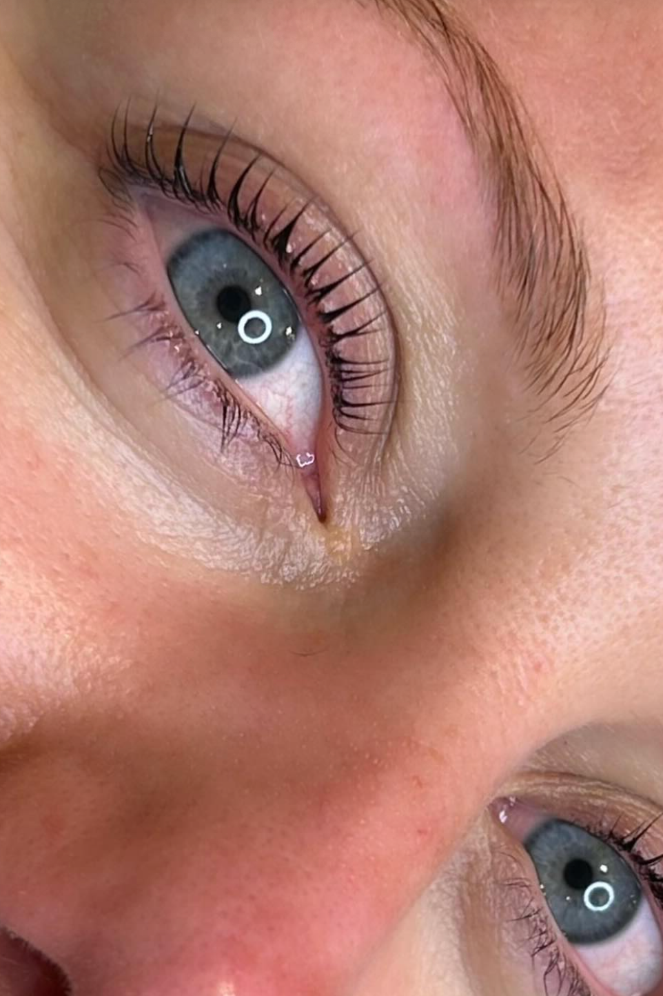 Close-up of a person's eye, showing blue iris, long eyelashes, and some skin texture around the eye.