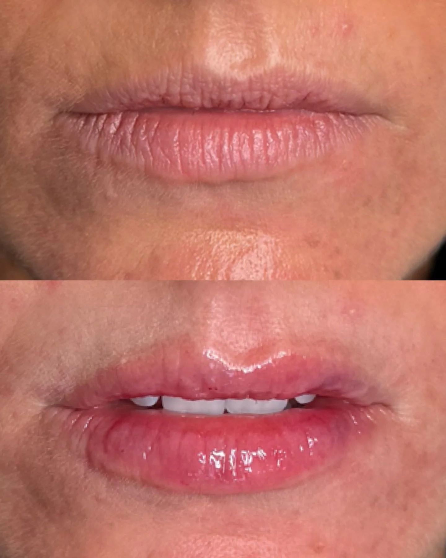 ✨ LUMI-PRO Lip Booster ✨

Your new go-to treatment for naturally plump, hydrated + irresistibly smooth lips 💋 
This is NOT FILLER

If your lips feel dry, flat or lacking definition, this treatment is a game-changer.
Formulated specifically for the d