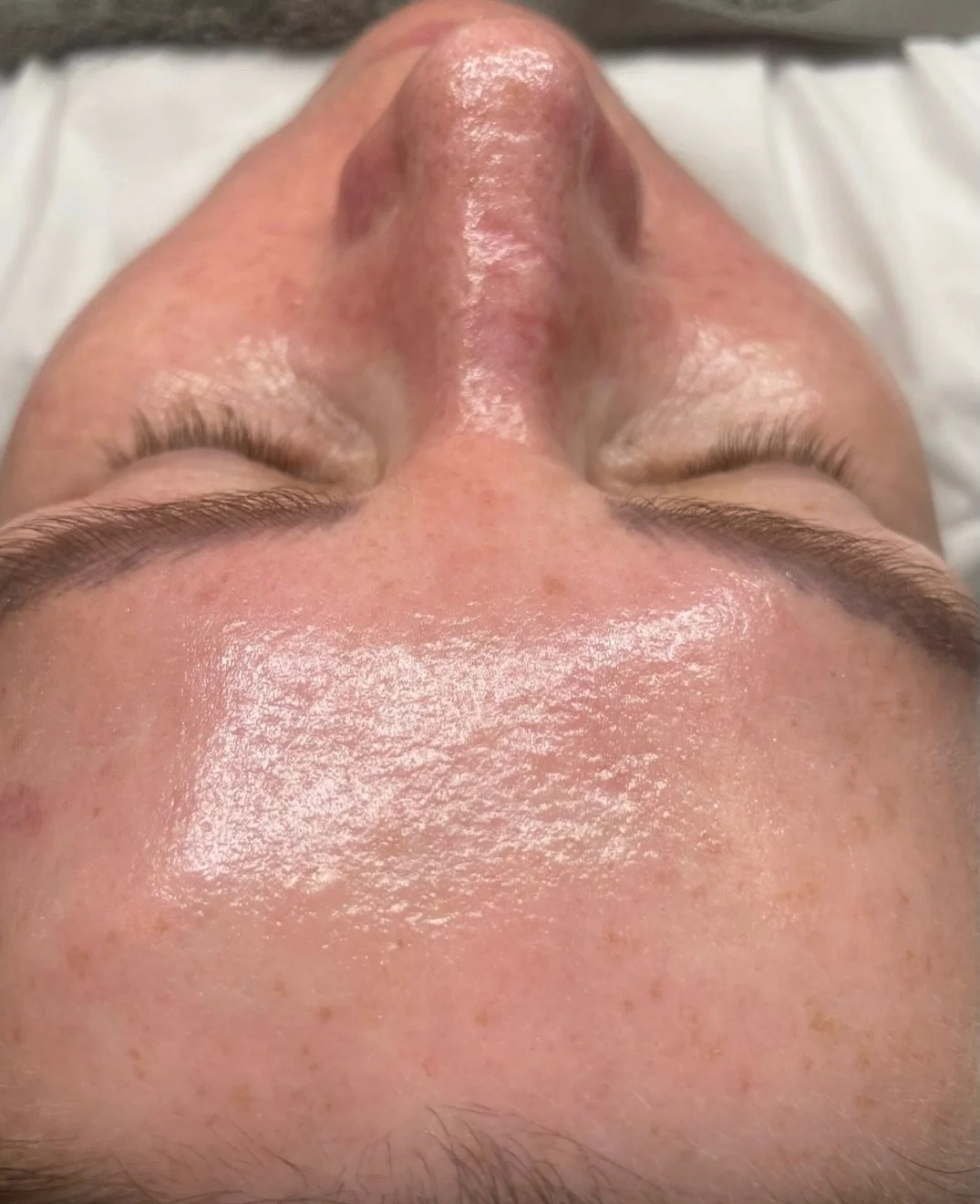 WANT SKIN THAT LOOKS FILTERED &hellip;. WITHOUT A FILTER?

If your skin is looking dull, congested or dehydrated.
Hydra Facial is one of my go to treatments for instant visible results 💧It delivers instant glow, deep hydration in just one session.

