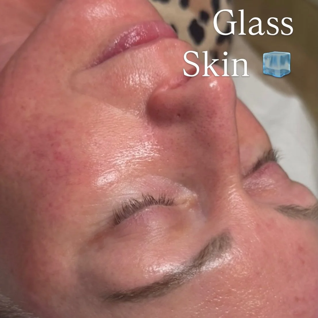 Glow Up Facial Dermaplane &amp; Chemical Peel ✨

Meet the treatment which gives you the ultimate glow up that makes skin look instantly smoother &amp; visibly brighter in one appointment.

The glow up facial combines professional Dermaplaning with a 