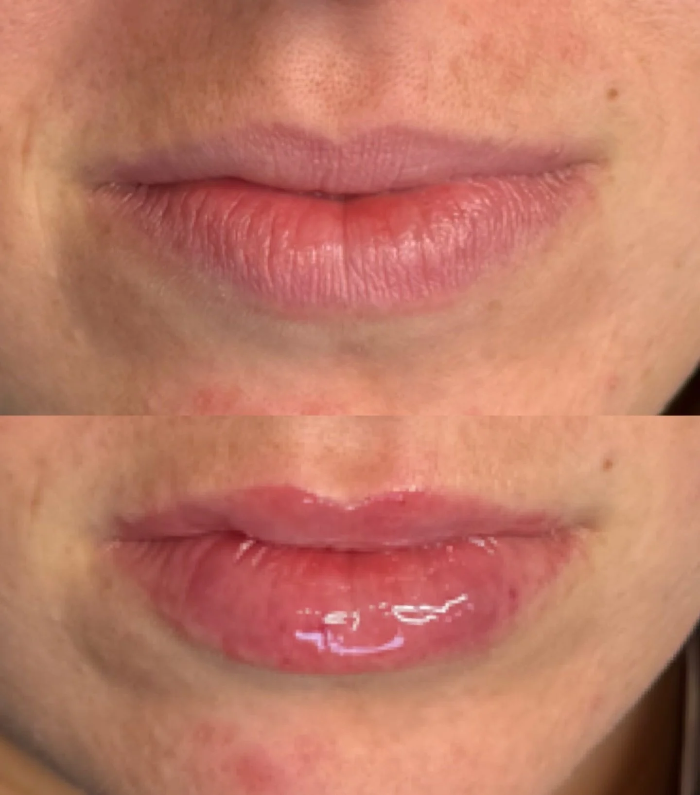 2026 Lips aren&rsquo;t bigger&hellip;.. they&rsquo;re better

This is a LIP BOOSTER not filler.

We&rsquo;ve stepped into the era of intentional enhancement-where technique, balance and skin quality matter more than size. 

The 2026 Lip Movement:
✔️B