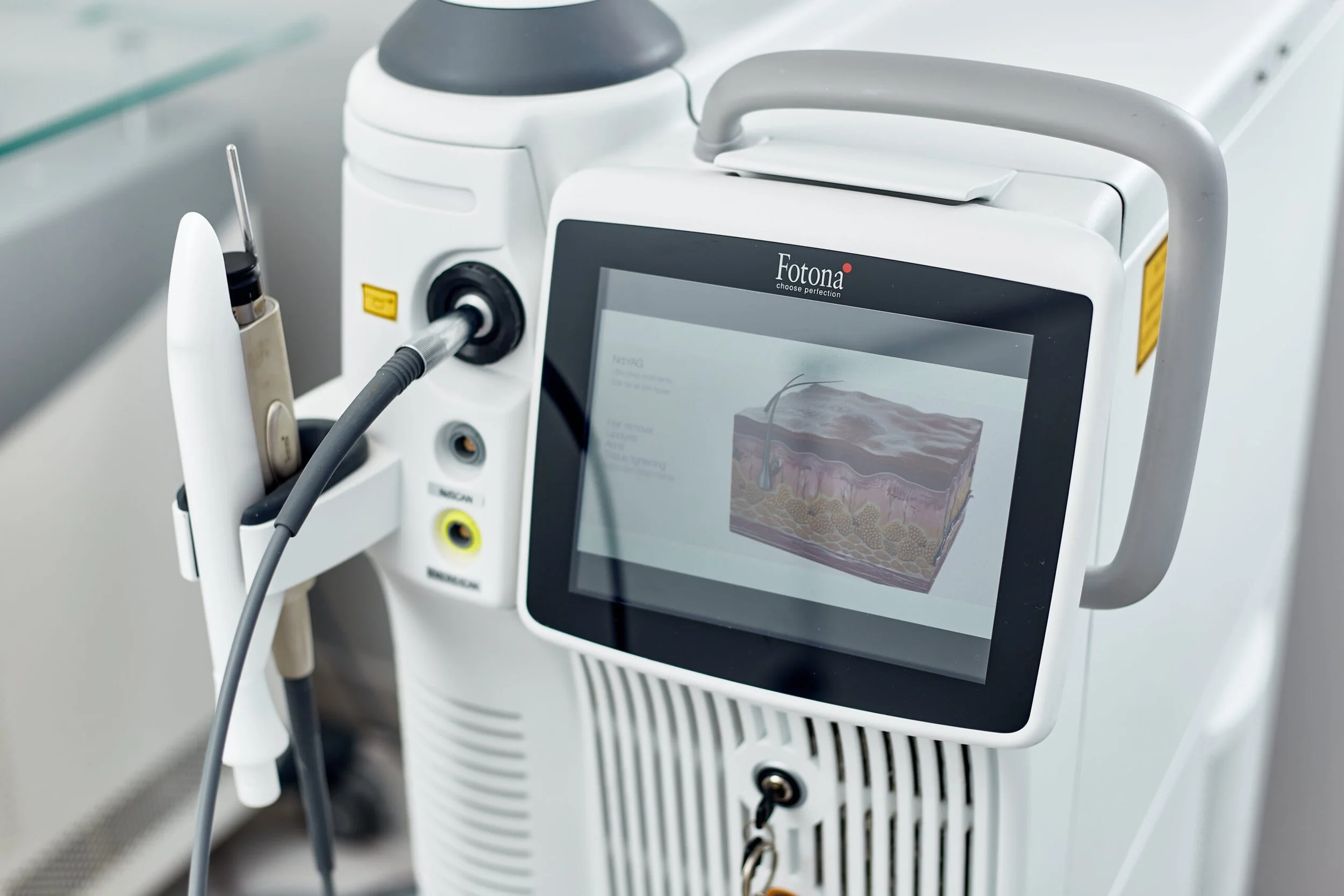 Medical device with a digital screen displaying a diagram of skin layers, labeled 'Fotona' and 'choose perfection'.