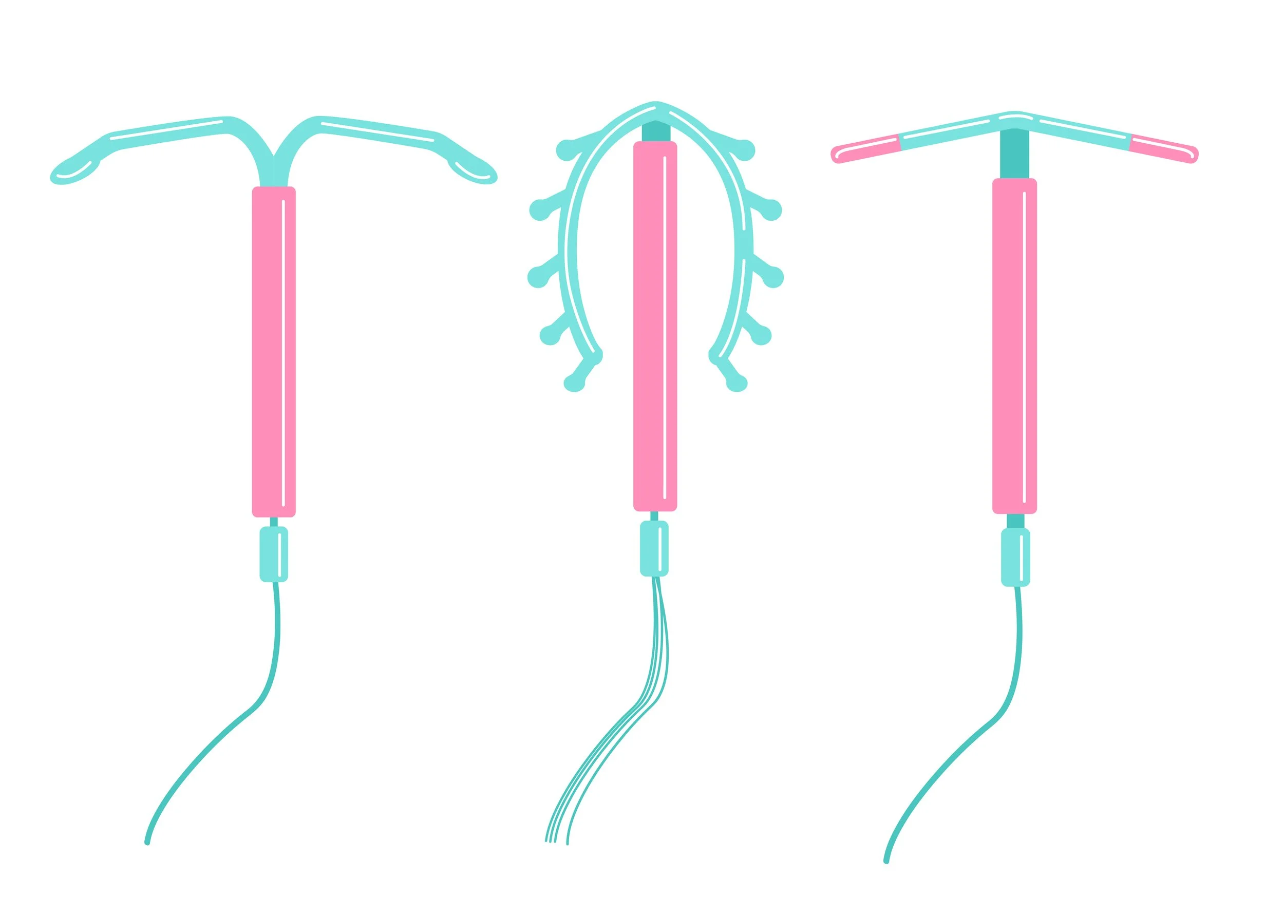 Everything You Need to Know about IUDs
