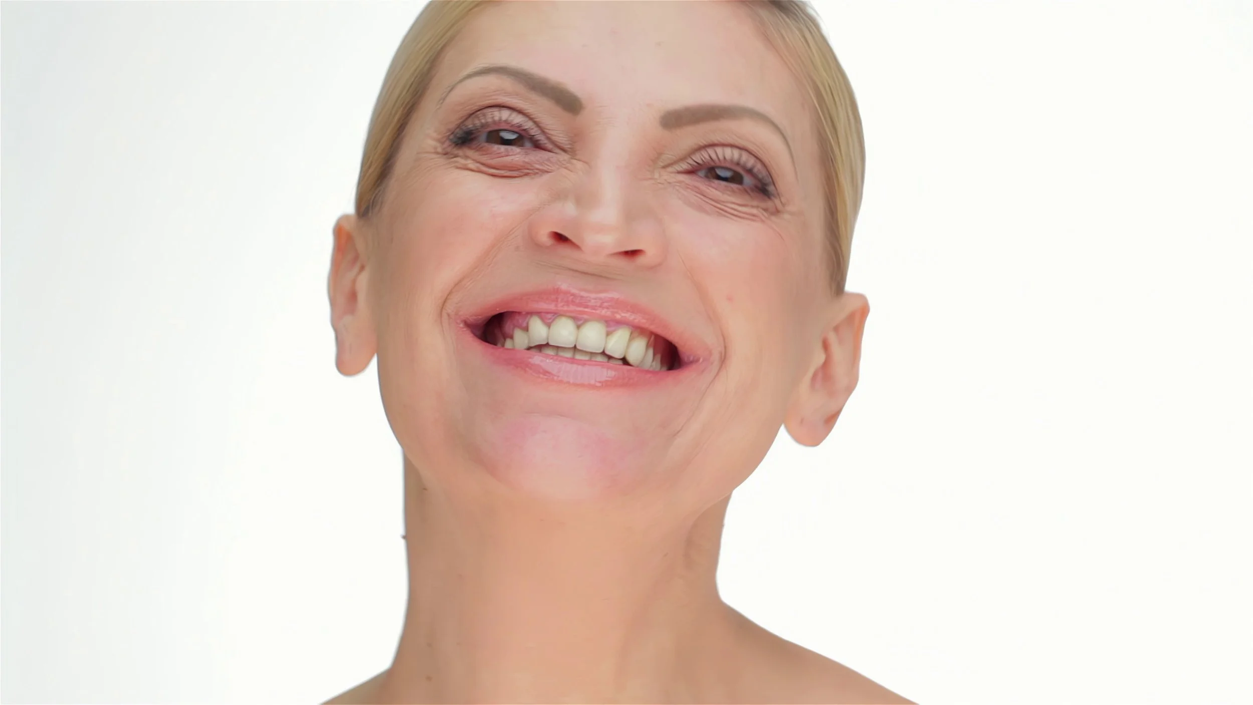 Morpheus8 vs. Microneedling: Which Skin Treatment Is Right for You?
