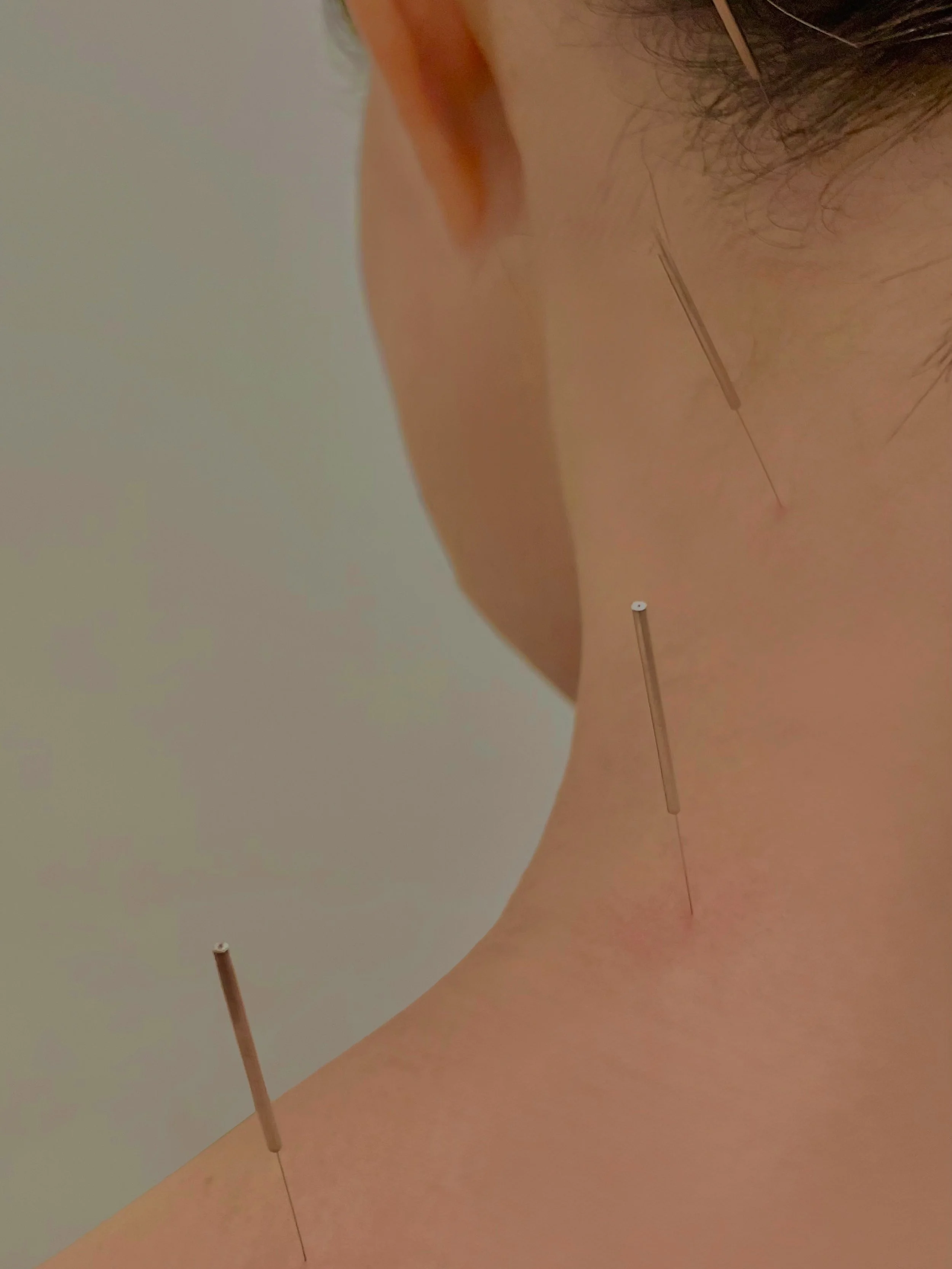 You&rsquo;d be surprised how much your body can let go
when you finally give it the chance.

Gamcho Acupuncture &amp; Wellness &middot; NYC
gamchonyc.com

#acupuncture #nycwellness #painrelief #gamcho