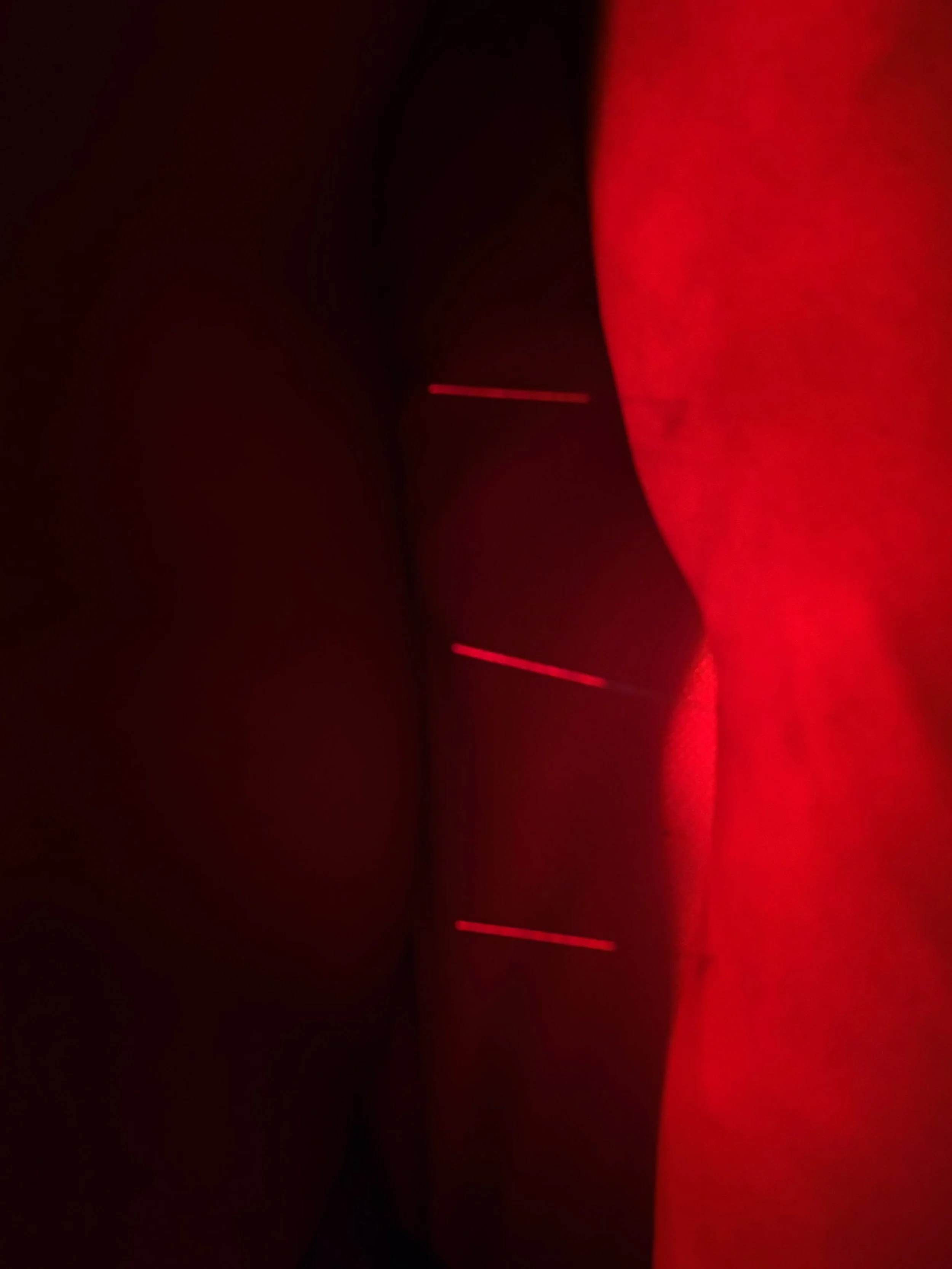 This is what relief looks like.

Gamcho Acupuncture &amp; Wellness &middot; NYC
gamchonyc.com

#acupuncture #painrelief #nycwellness #gamcho