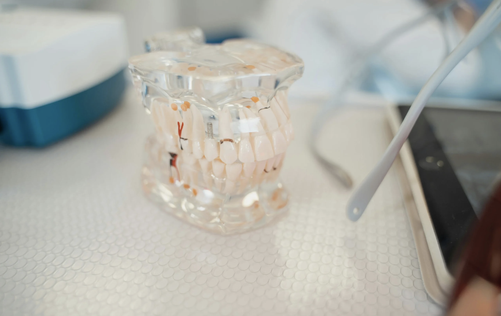 Como Funciona o Clareamento Dental Profissional?