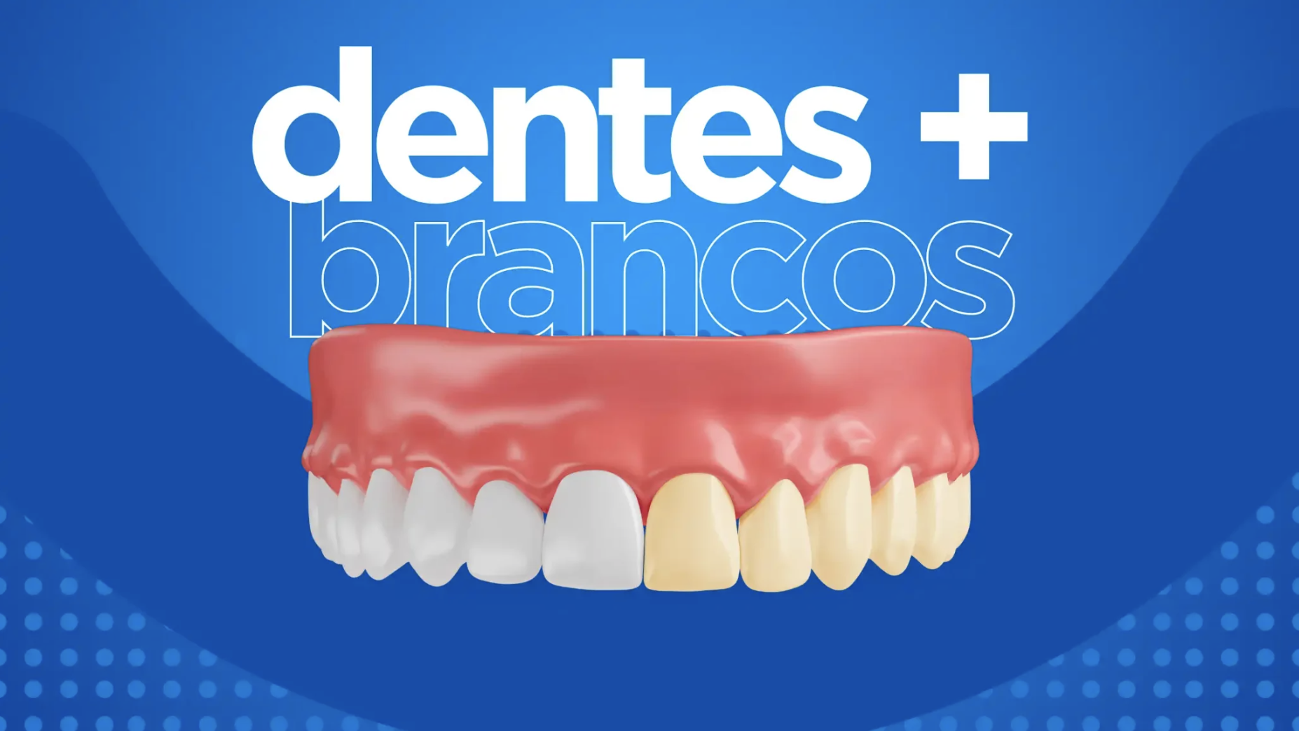 Dentes mais brancos: Clareamento é no ColinaClin