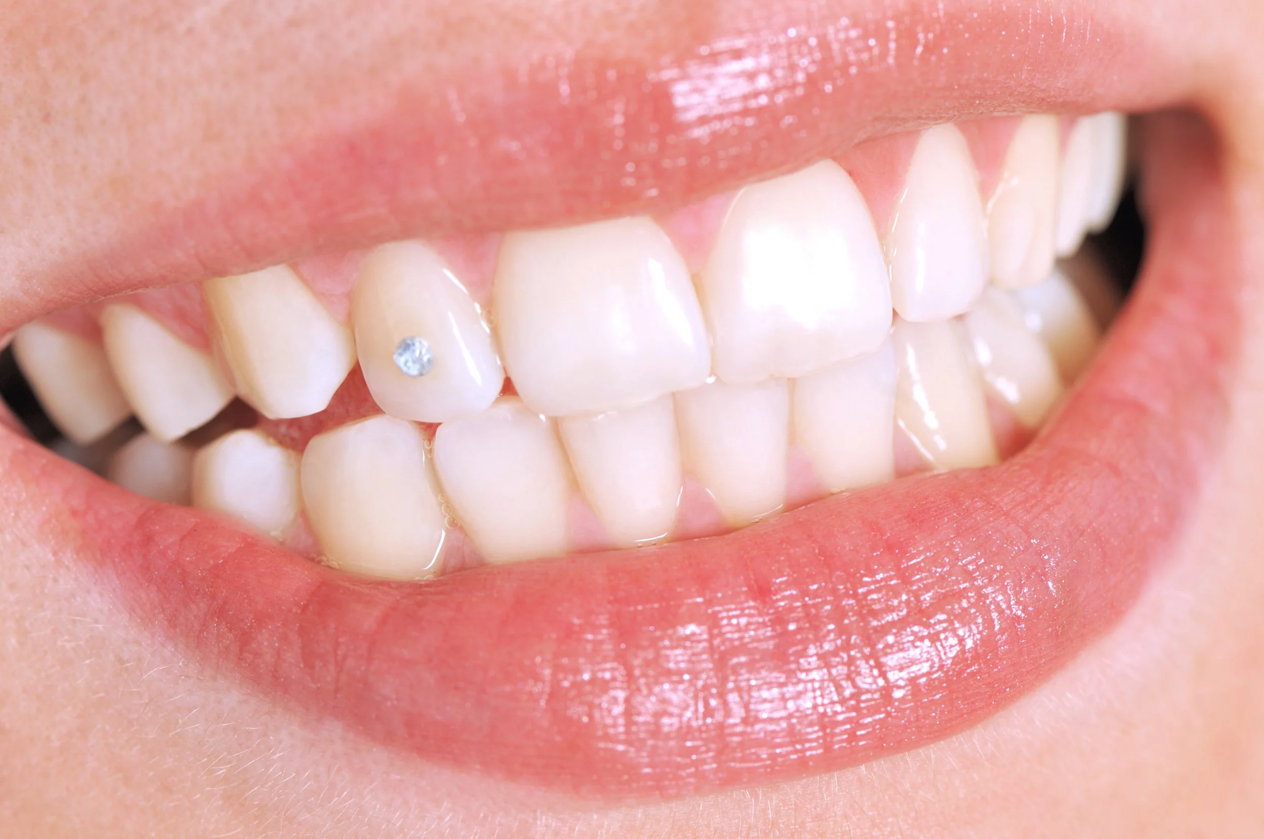 Close-up of a person's smiling mouth showing white teeth and lips with a small dental jewel on one tooth.