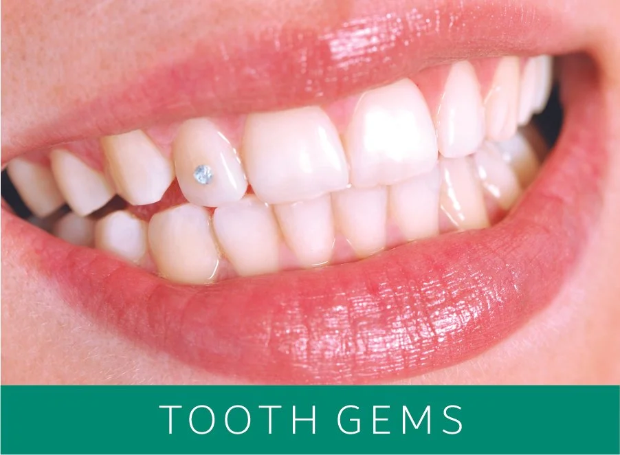 Close-up of a smiling person's teeth with a small decorative gem on one tooth, captioned 'Tooth Gems'.