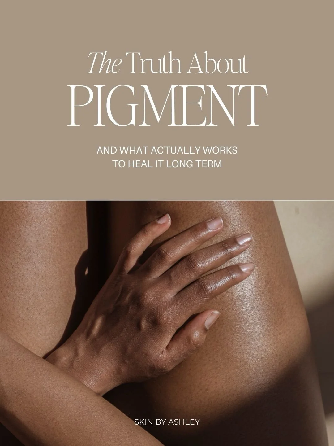 Let&rsquo;s be real &mdash; pigment is a pain. 😬

It shows up uninvited as sun spots, melasma, or acne marks&hellip; and once it&rsquo;s there, it loves to overstay its welcome.

Our strategy:
&ndash;SPF daily
&ndash;Chemical peels for surface disco