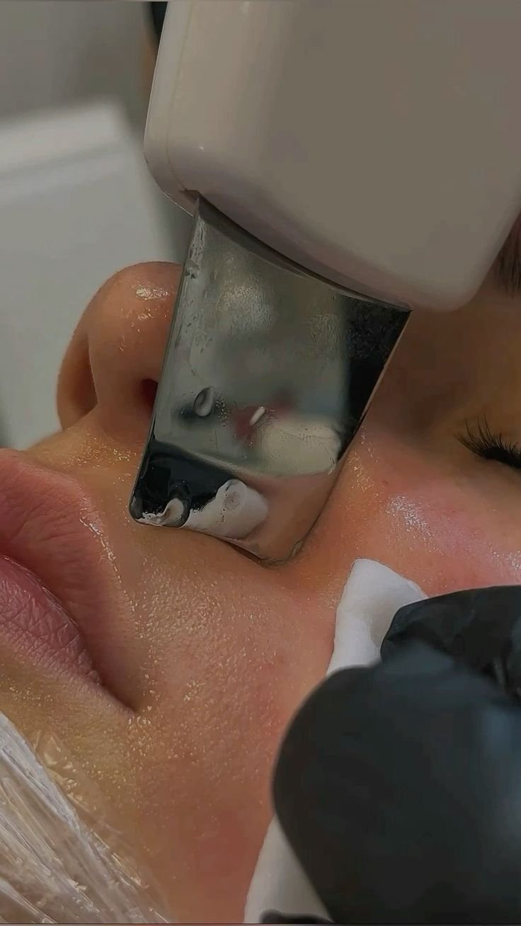 Close-up of a person receiving an ultrasonic facial treatment, with a device pressed against their cheek and a gloved technician holding the device.