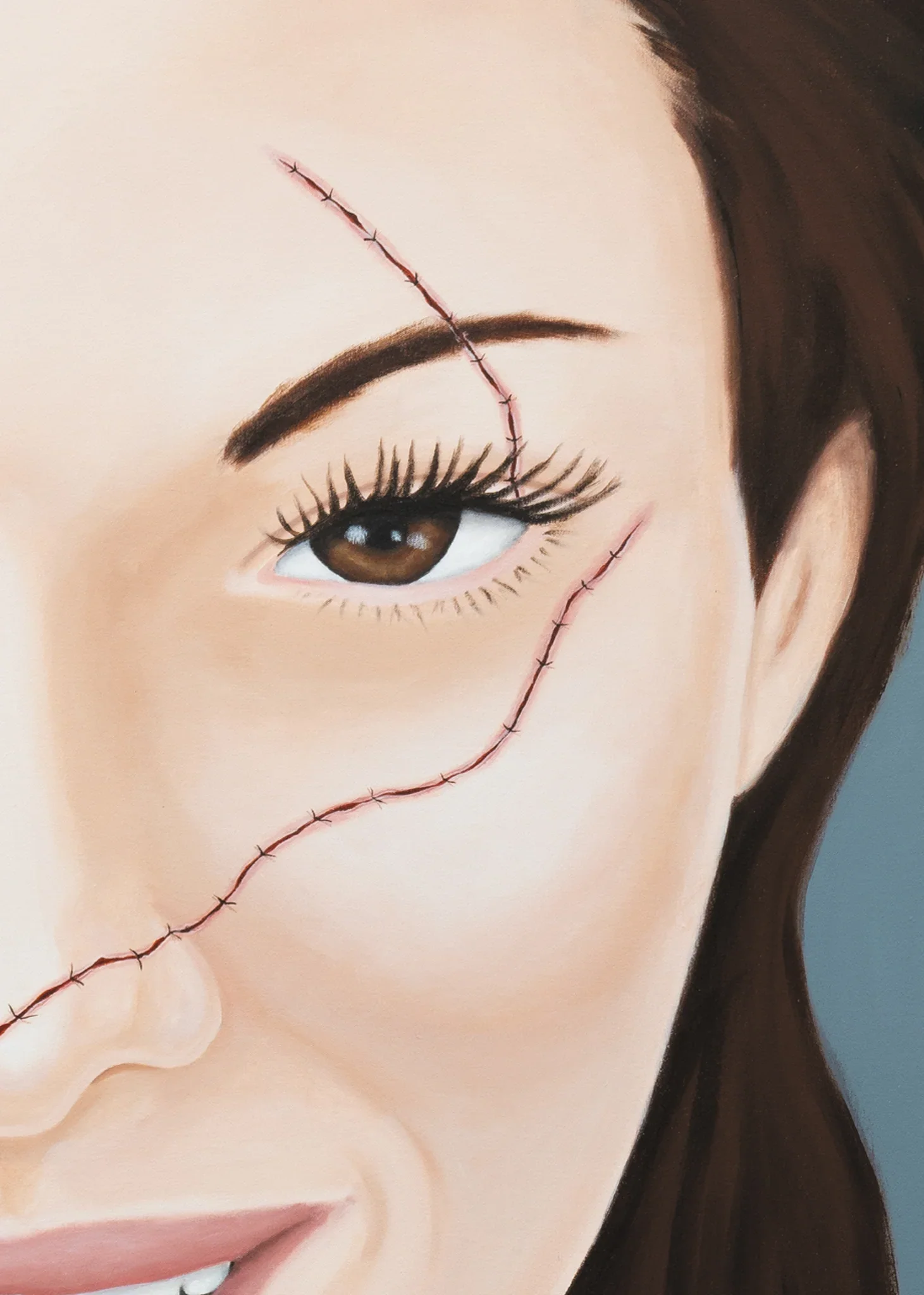 Close-up of a woman's face with brown hair, brown eye, and long eyelashes, featuring a large stitched scar across her face.