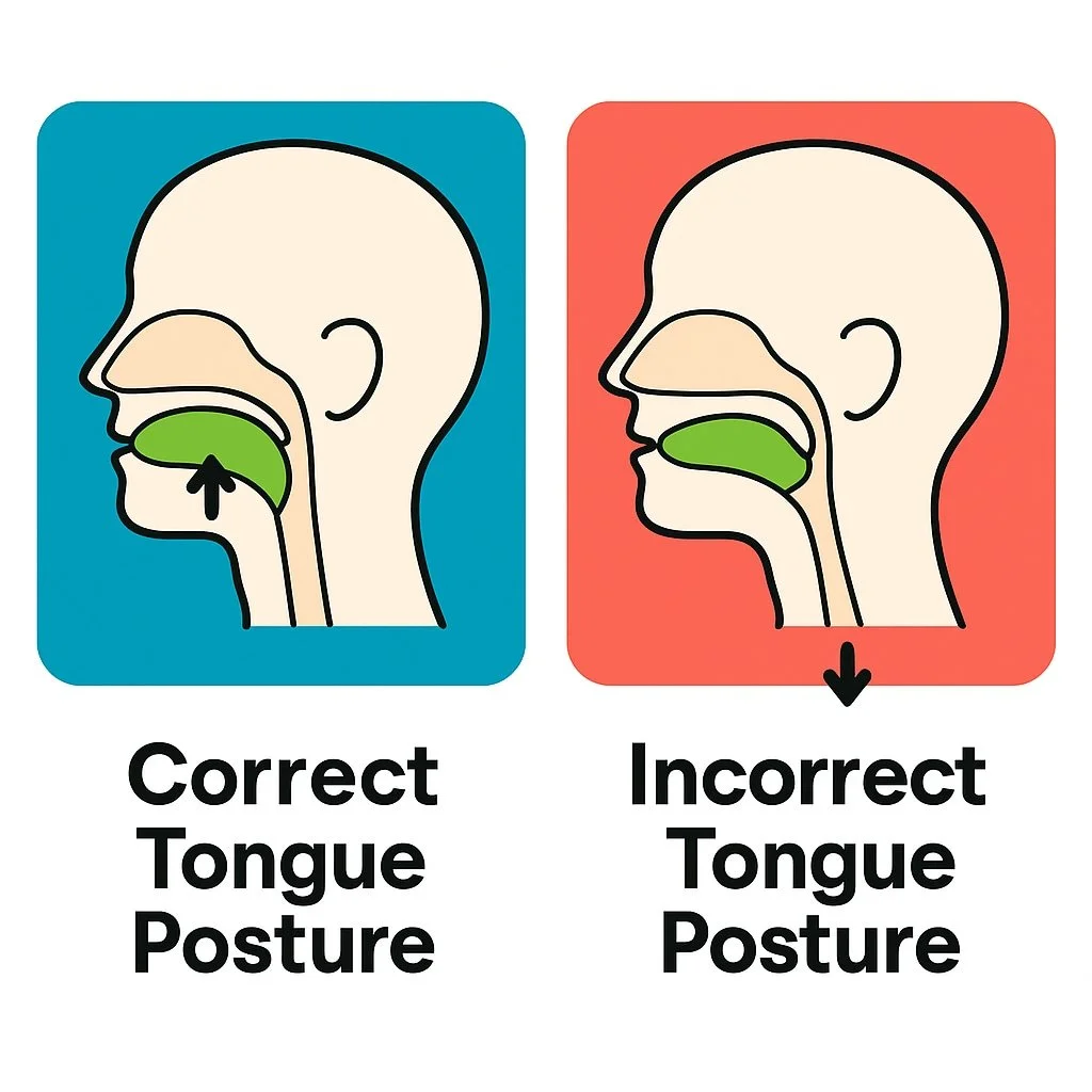 A graphic demonstrating correct versus incorrect tongue posture or carriage.