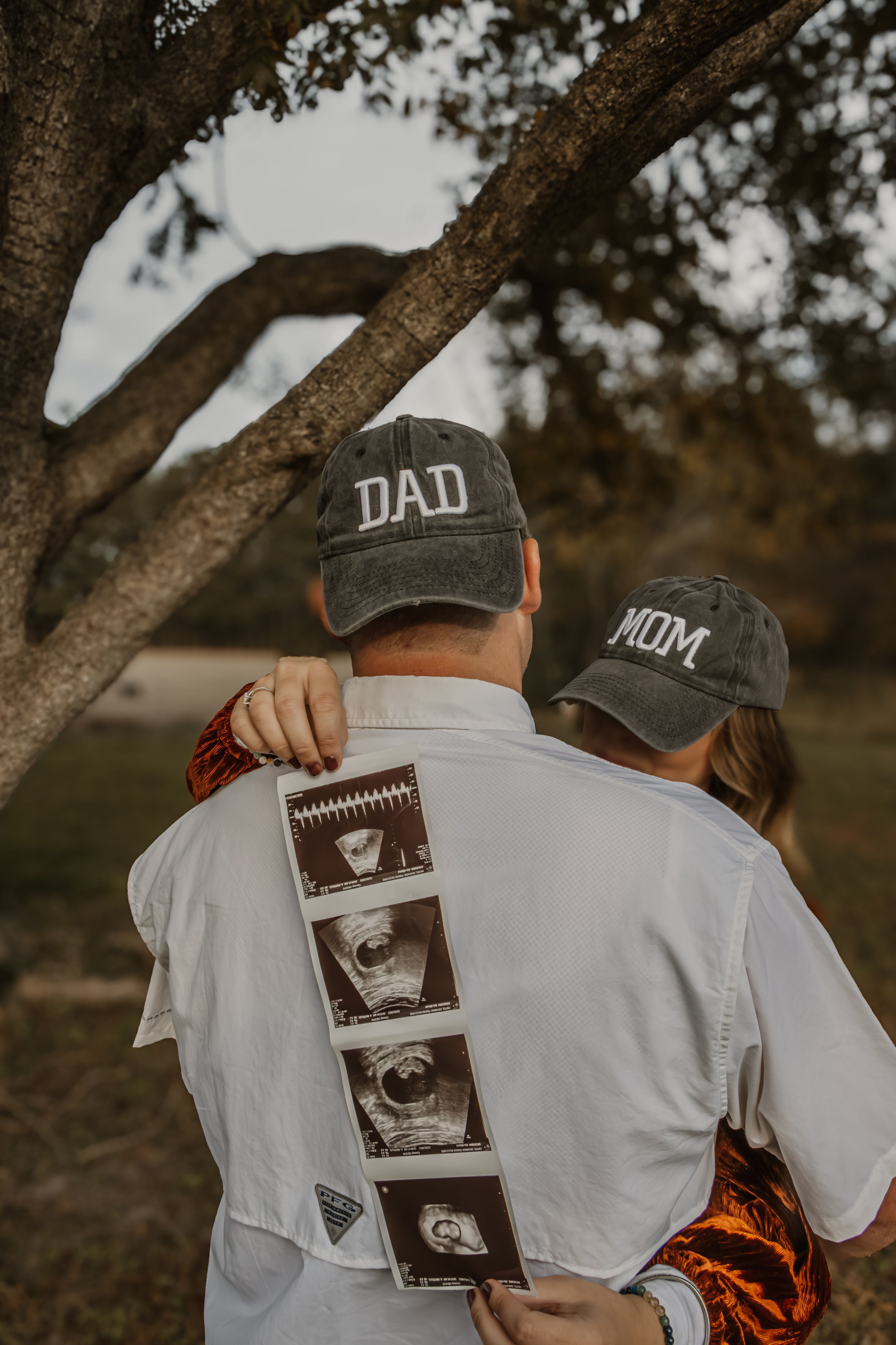 Couple wearing 'Dad' and 'Mom' hats standing outdoors, with ultrasound images taped to the back of the dad's shirt.