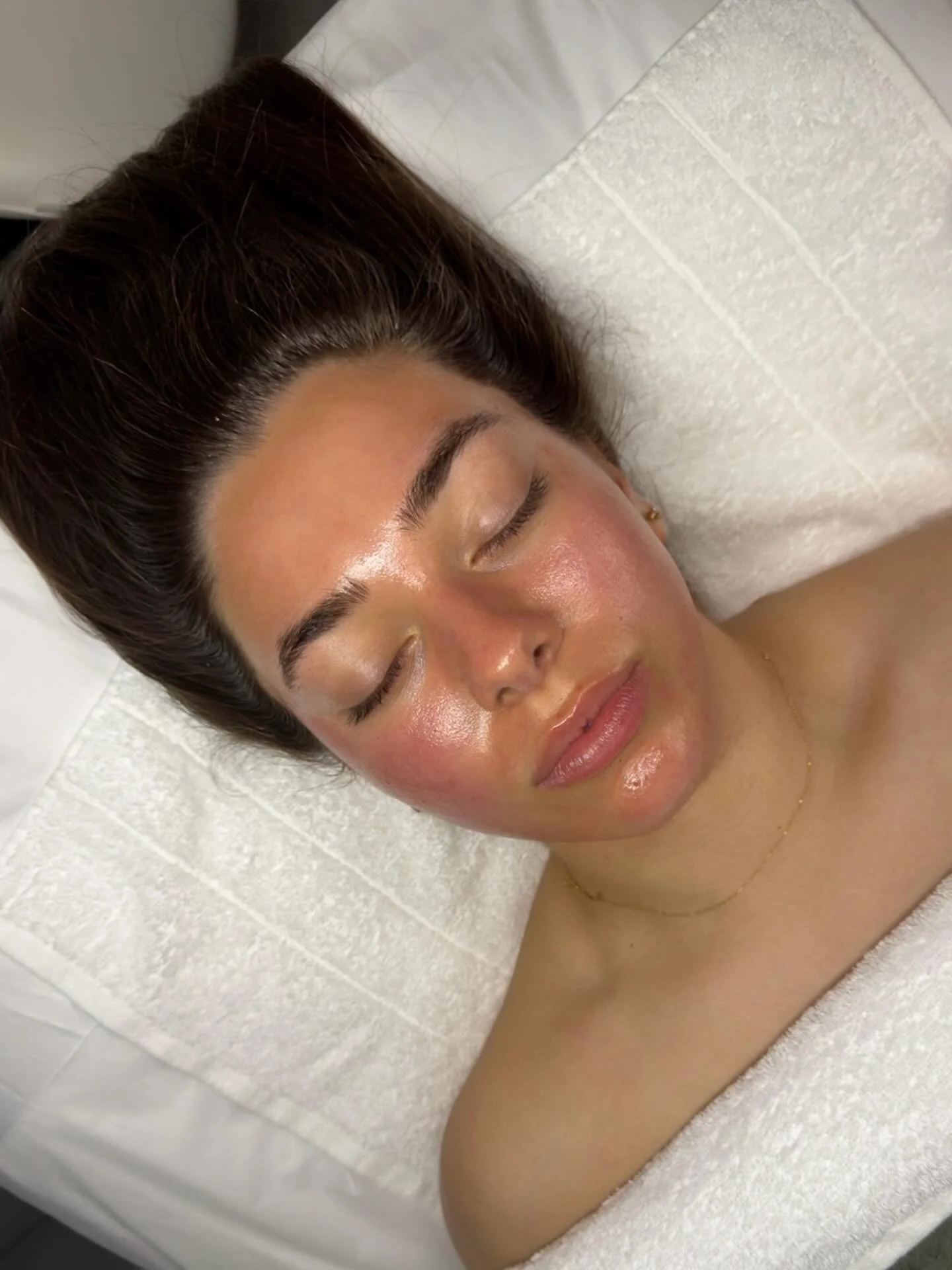 Our favourite pathway to glass skin✨

Laser Lift &amp; Infuse X Resurface+ 
A results driven treatment that works to refine texture, remove dull, superficial buildup, stimulate collagen and enhance your cell turnover to strengthen the dermal matrix. 