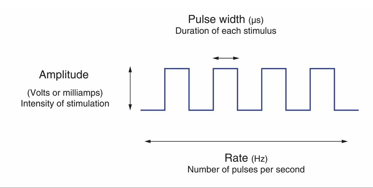 Stimulation parameters. The three settings we adjust are amplitude, pulse width, and rate.