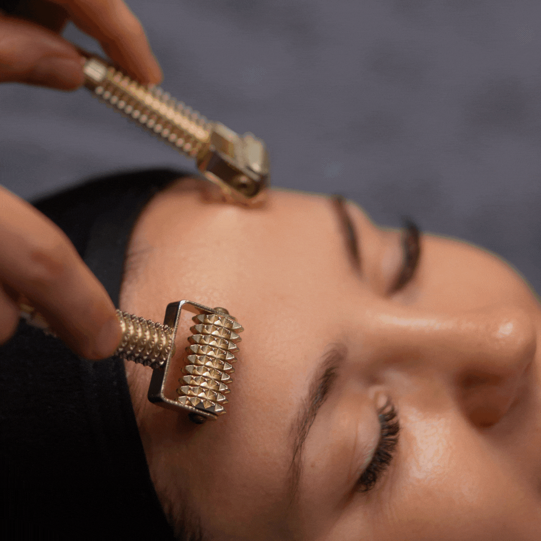 A person receiving a facial treatment with metal rollers on their face, including the forehead and jawline, while lying down with eyes closed.