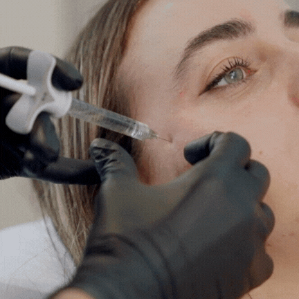 A person receiving a cosmetic injection near the eye, with a healthcare professional wearing black gloves administering the procedure.