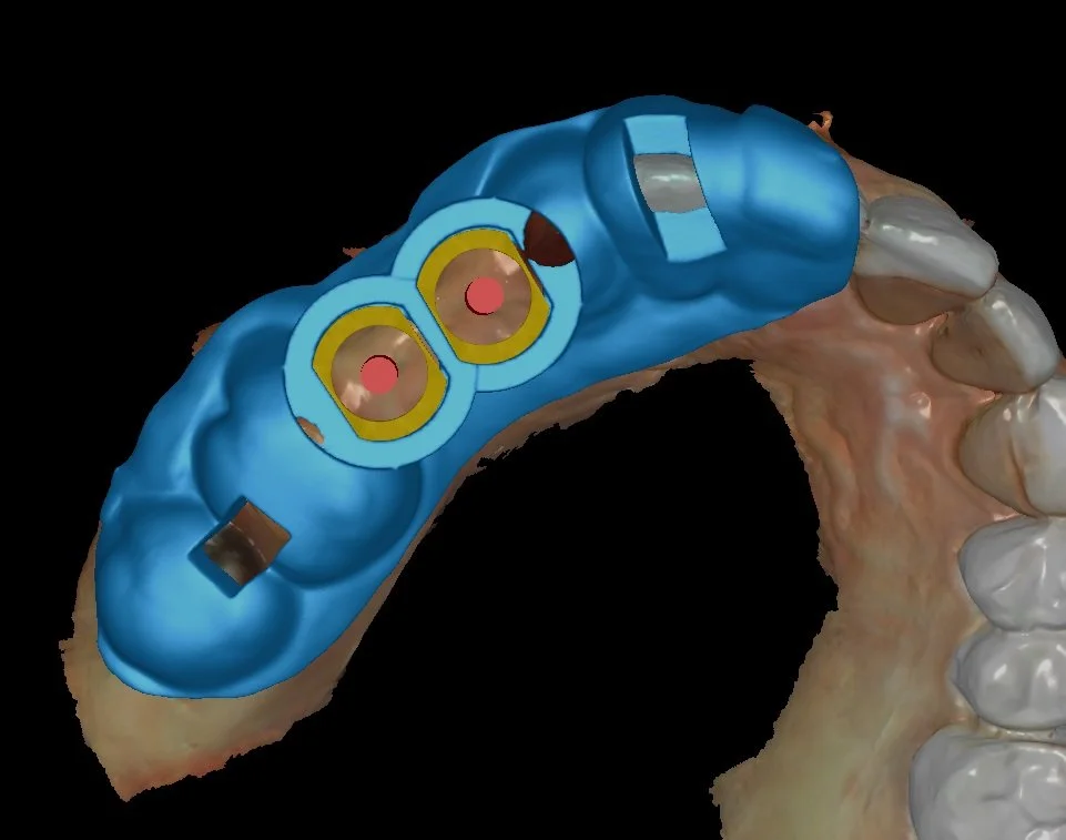 How technology makes the result precise