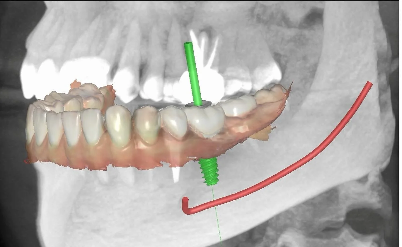 واحدة من أهم العوامل لنجاح عملية الزراعة هي استخدام التقنيات الحديثة والزراعة الرقمية ، كل حالة يتم دراستها بعناية على حده 🙏🏼For more information, feel free to contact me at 0585829810