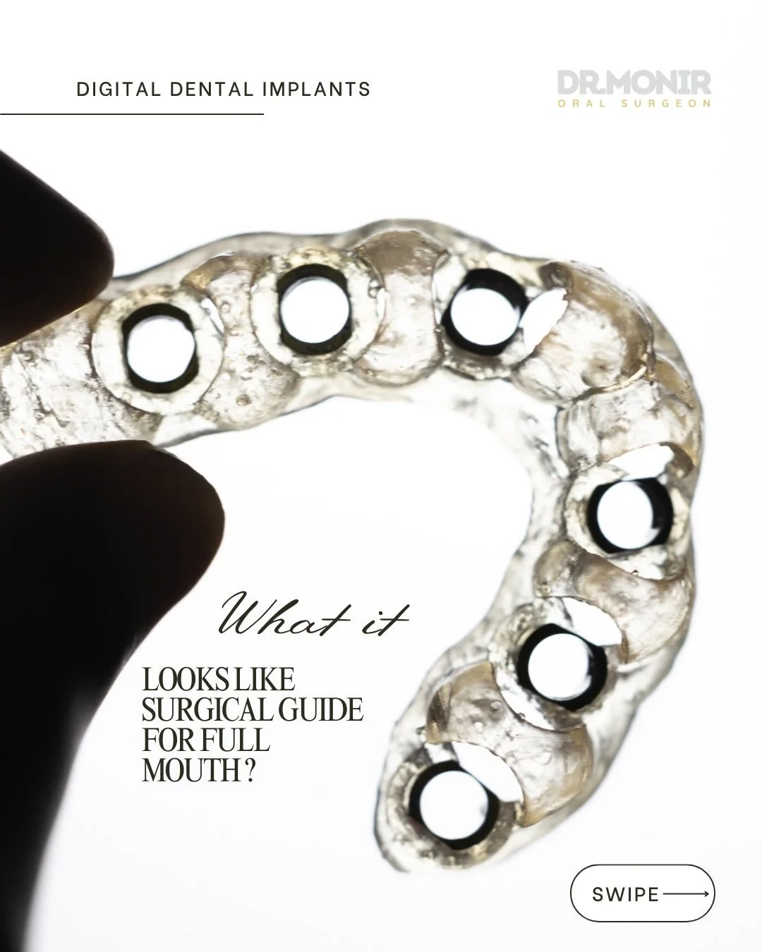 Digital implants placement becomes popular these days due their efficacy, accuracy and easy to implement to the dentist and to the patient. 

In this case, patient was suffering from ling time from teeth that they are moving causing pain and one by o