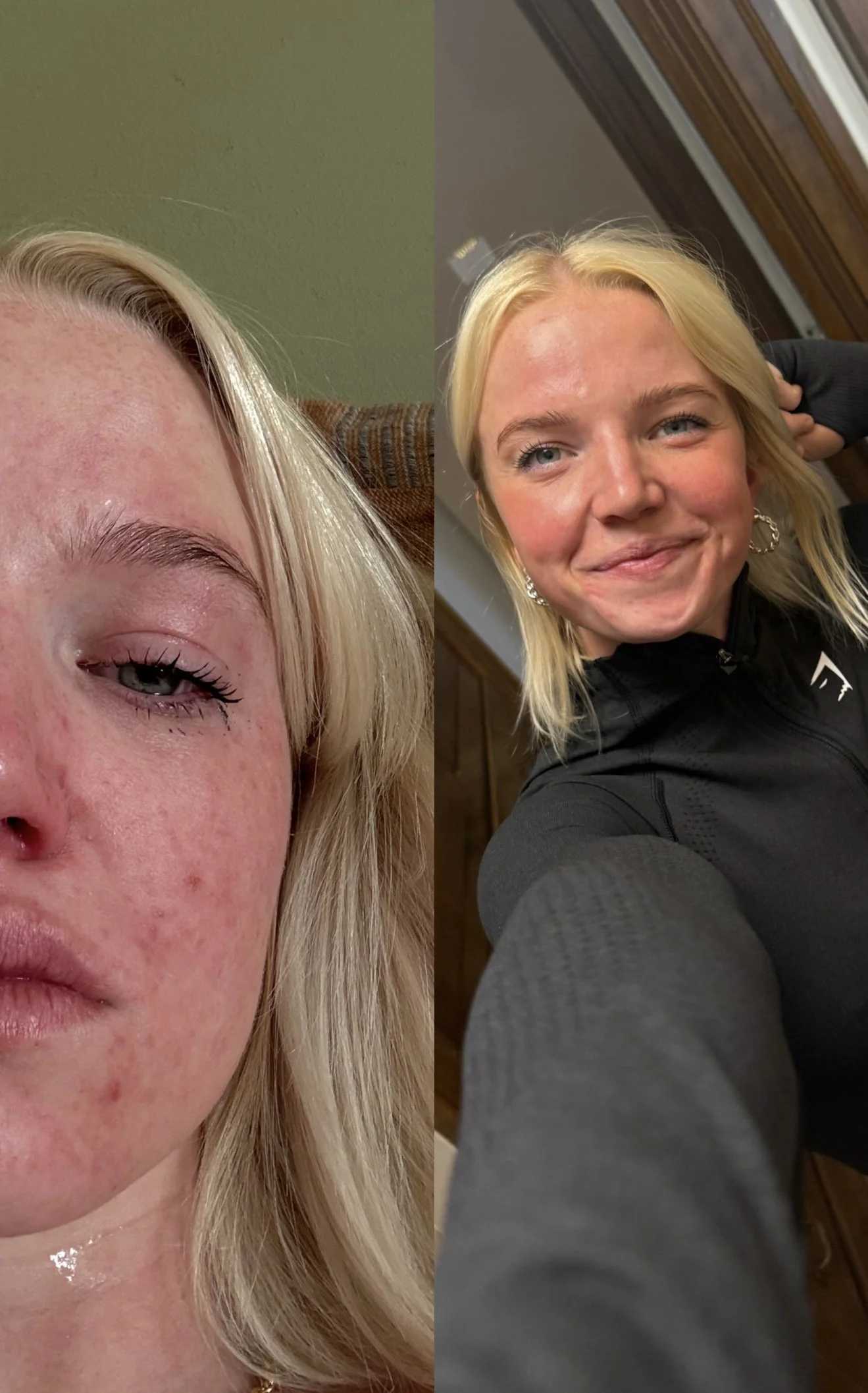 the un-aesthetic truth about my “glow up”