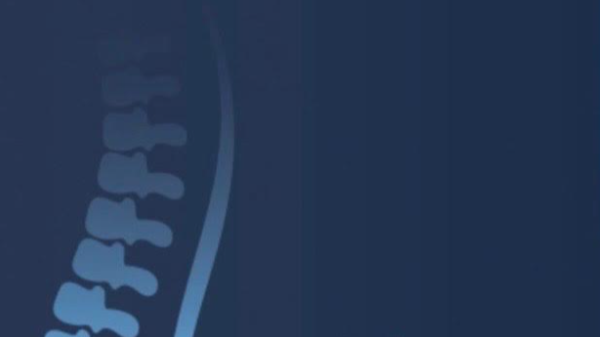 An X-ray image of a human spine.