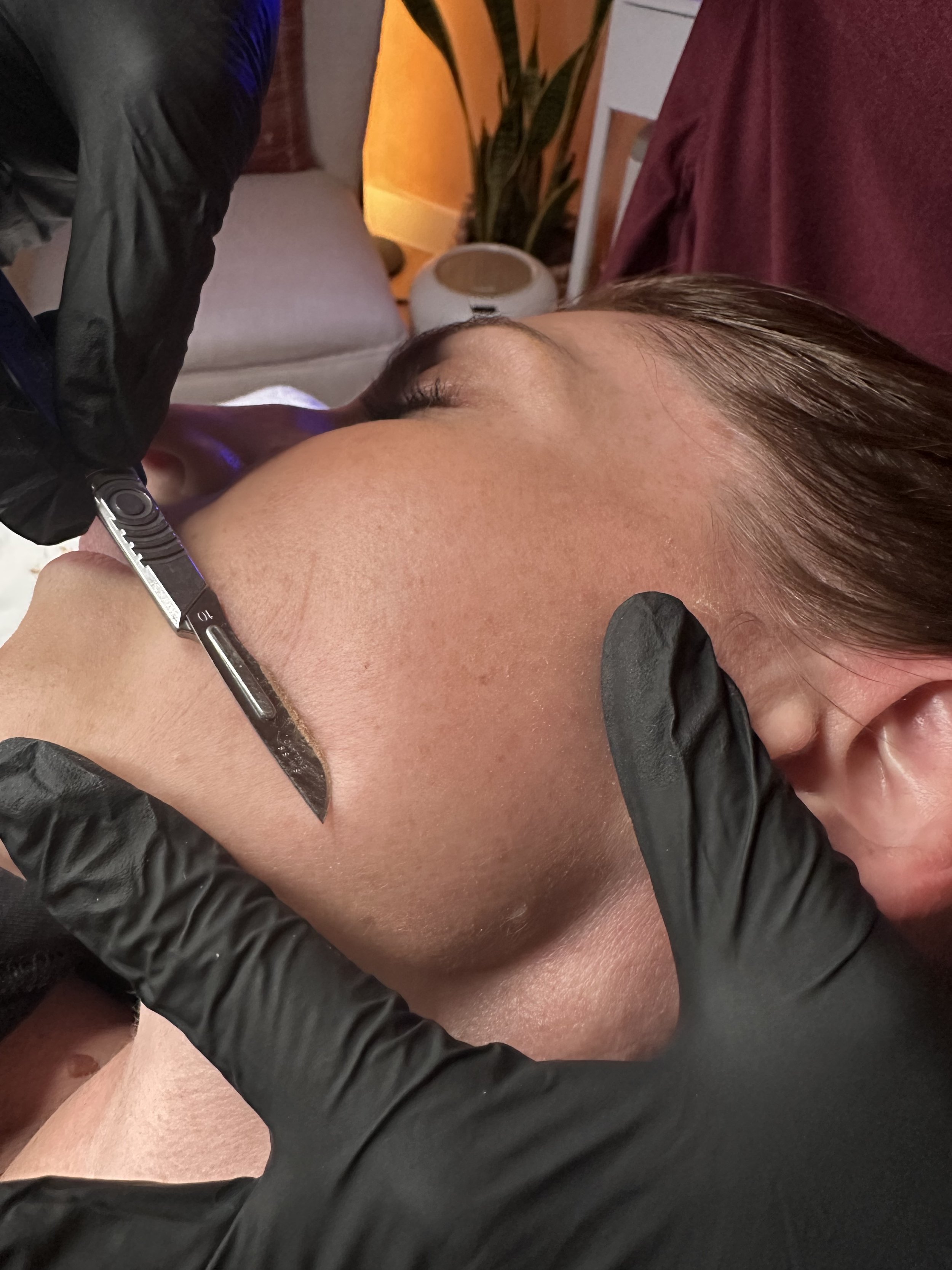 A person receiving a cosmetic tattoo procedure on their shoulder, with a close-up view of the process, wearing black gloves and reclining on a bed.
