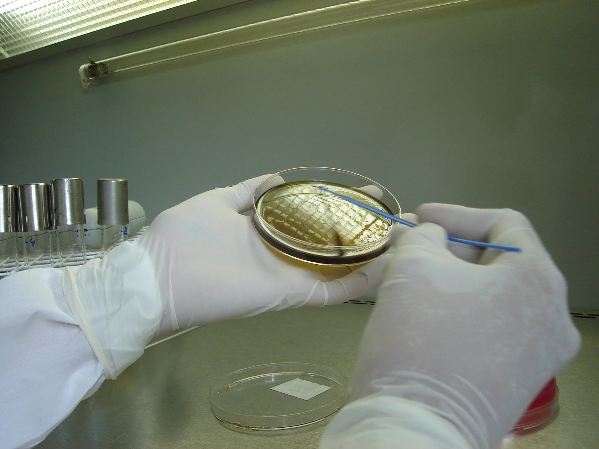Beyond Antibiotics: Why Precision Matters in the Fight Against AMR