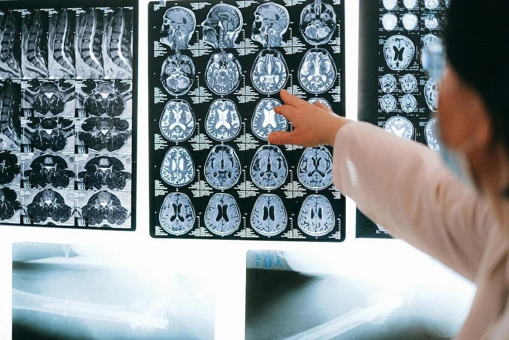 radiologist reading MRI of head