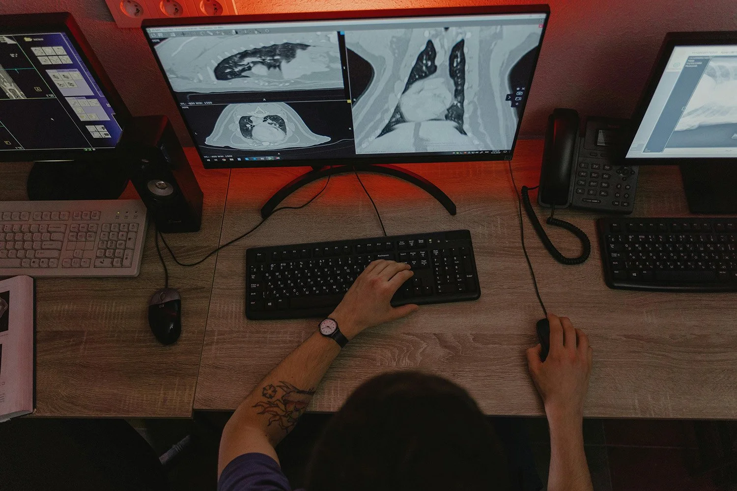 Person working at a desk with two monitors displaying medical images, a keyboard, mouse, telephone, and other office equipment.