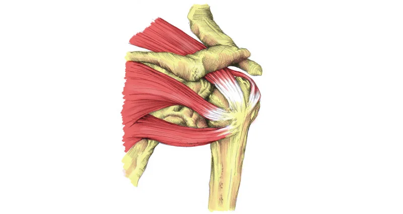 Common Causes of Shoulder Pain - Rotator Cuff 