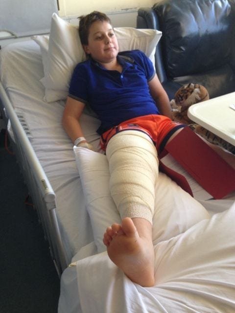 A young boy lays in a hospital bed with bandage covering the whole of one leg