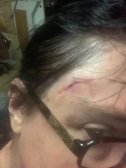 Close up of Fleur's head with a scar on her forehead on the side