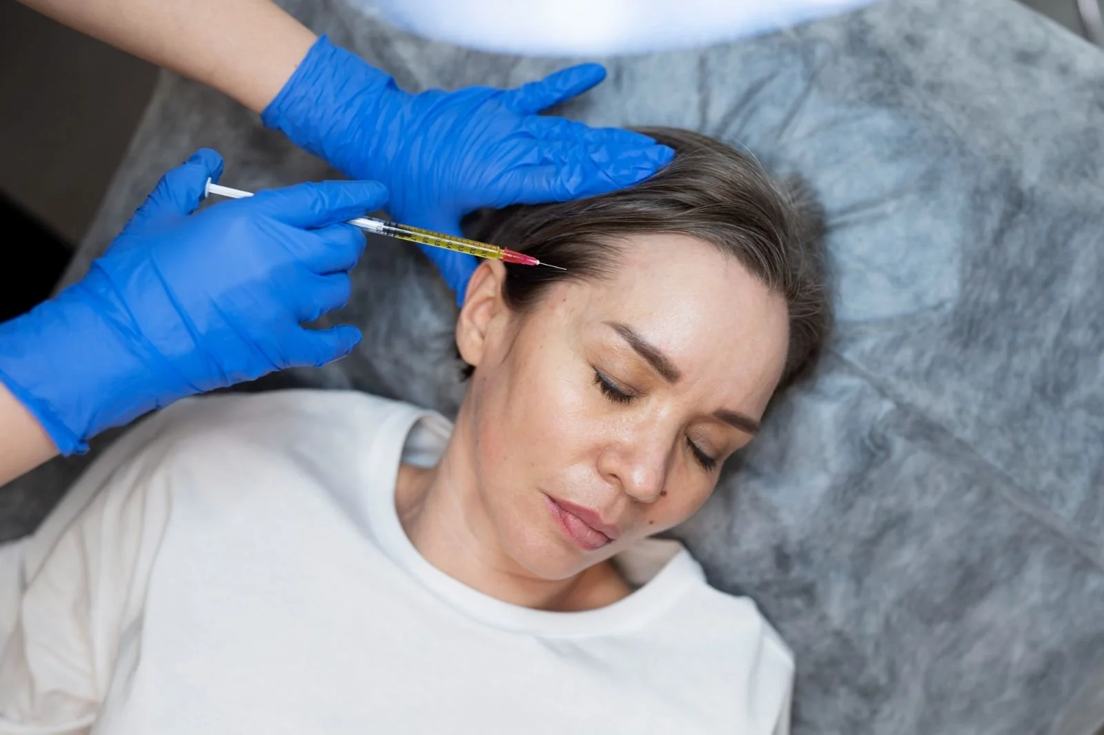 A woman is lying down with her eyes closed, receiving an injection in her forehead from a medical professional wearing blue gloves.