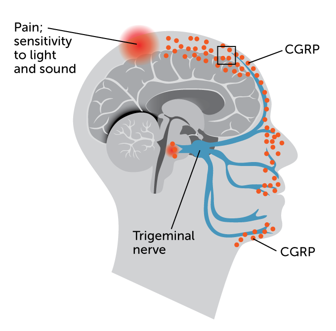 Diagram showing the trigeminal nerve and areas affected by pain or sensory signals in the brain and face, with red highlighted regions indicating nerve pain.