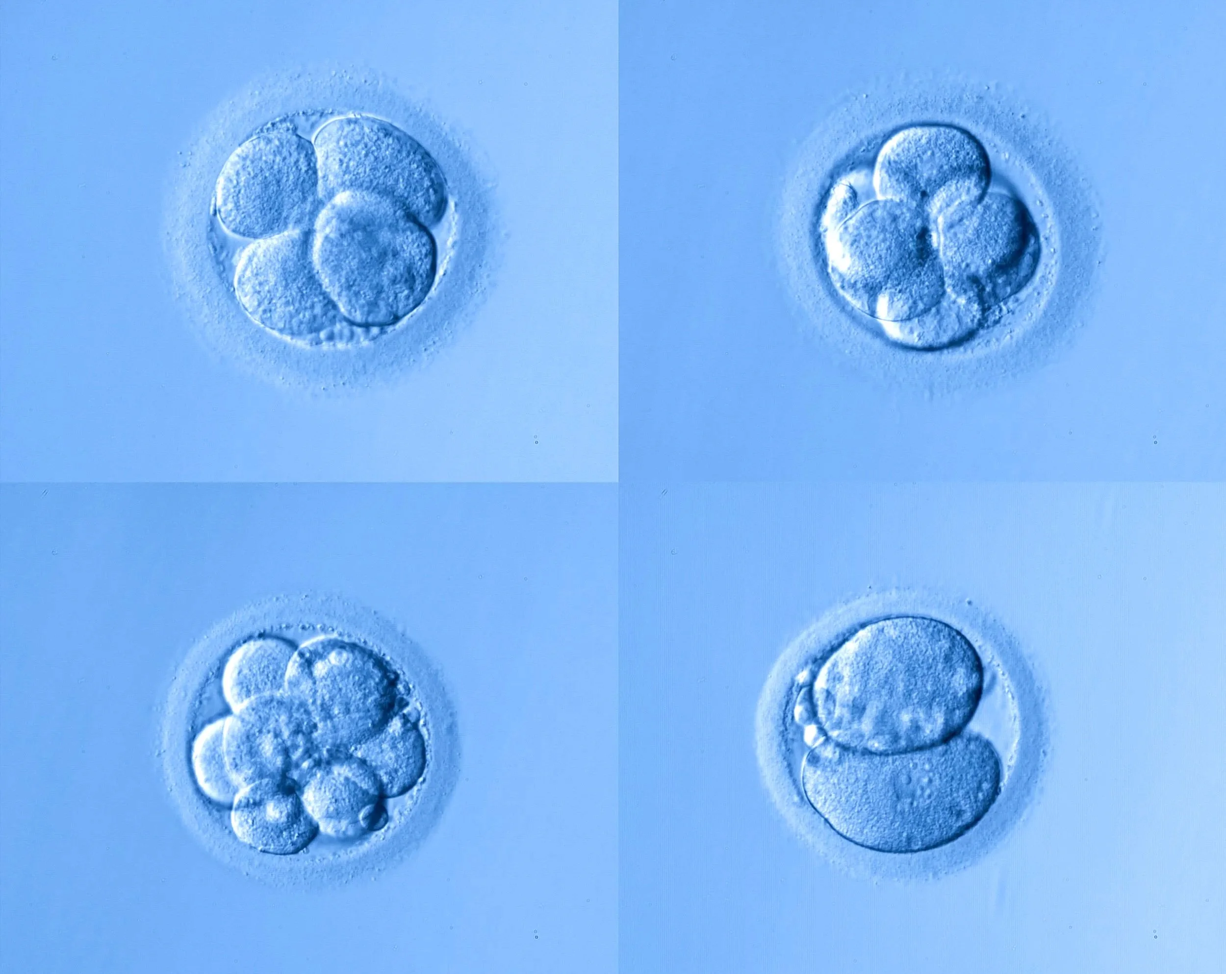 Four panels showing the stages of human embryo development at the cellular level in blue tones.