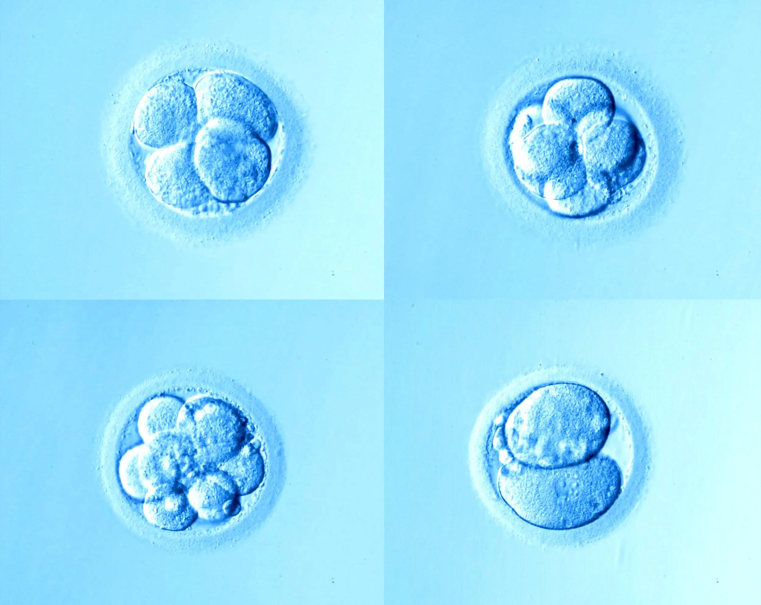 Four panels showing a human embryo at different stages of cell division.