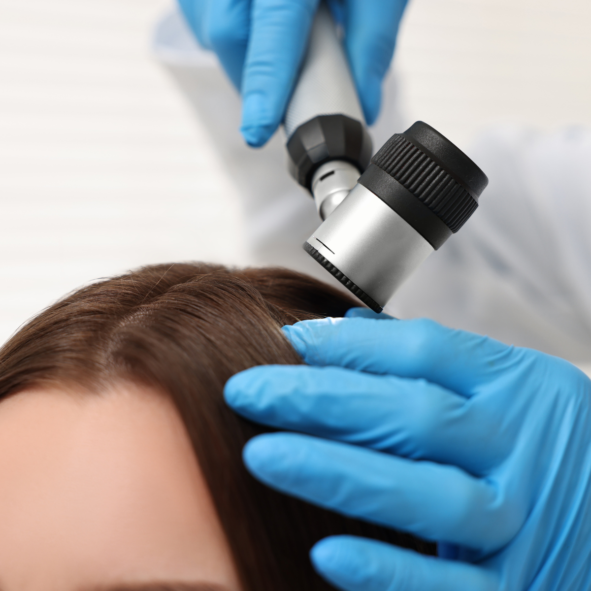 Caduta Capelli in Inverno: Perché Aumenta, Quando Preoccuparsi e Come Fermarla Davvero